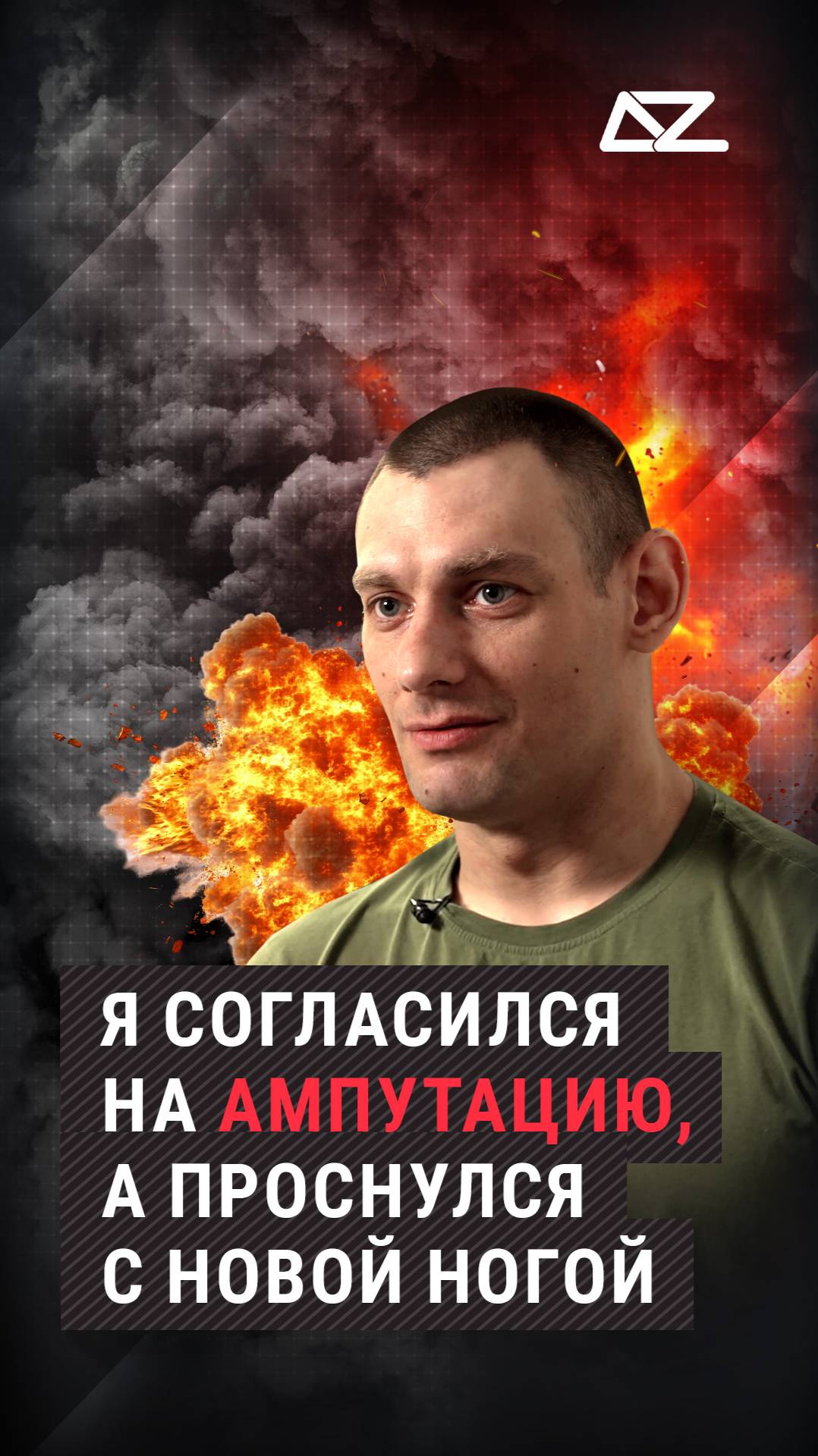 Я согласился на ампутацию, а проснулся с новой ногой | Гонка на выживание смотреть онлайн