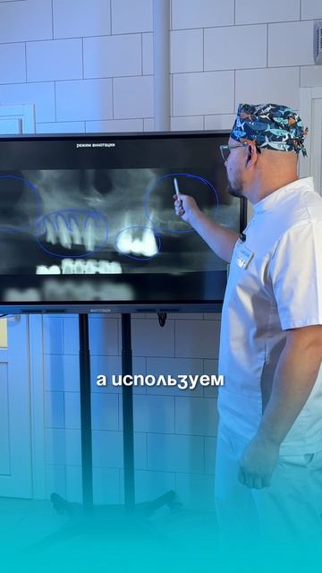 4 имплантат или съемный протез?