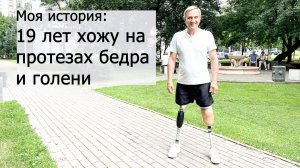 19 лет на протезах бедра и голени - история Александра