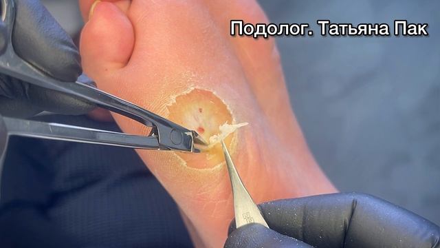 И в такой размер может вырасти смотреть онлайн