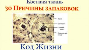 28 Код Жизни, Причины запаковок и костные ткани. Кто что ломал и почему #Сорадение #КодЖизни #Кости