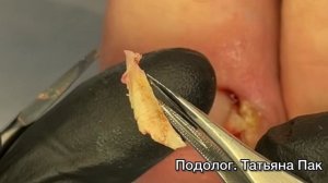 Лишние части