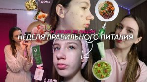 КАК ИЗБАВИТЬСЯ ОТ ПРЫЩЕЙ?! || НЕДЕЛЯ ПРАВИЛЬНОГО ПИТАНИЯ