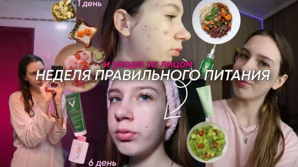 КАК ИЗБАВИТЬСЯ ОТ ПРЫЩЕЙ?! || НЕДЕЛЯ ПРАВИЛЬНОГО ПИТАНИЯ