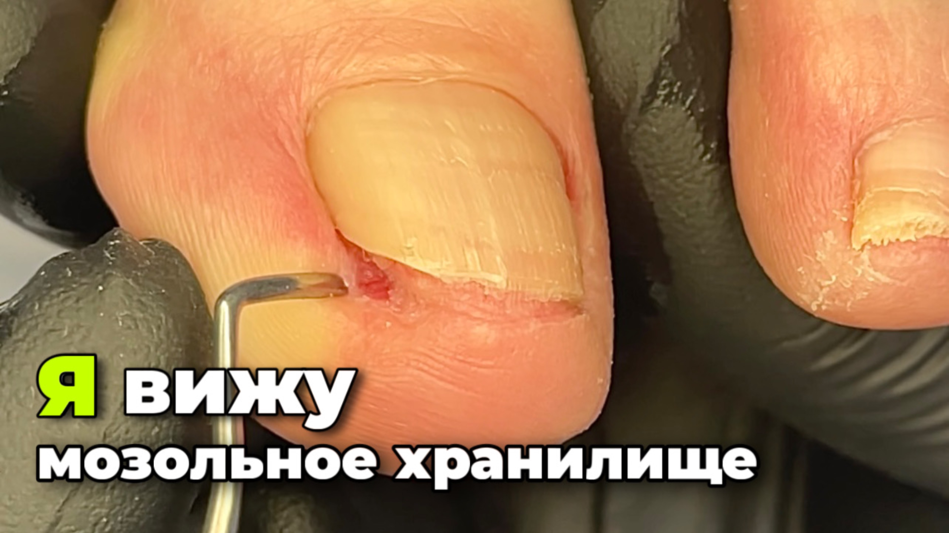 Вытащить угол смотреть онлайн