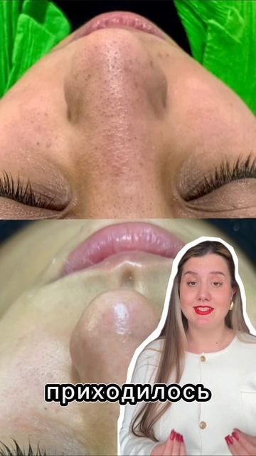 Тоник-сыворотка от акне Cosmeya #WW152240 / Гель от черных точек #WW152227 WB #бьюти #уход #обзор