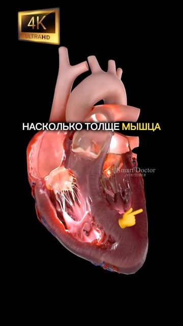 Левый желудочек сердца смотреть онлайн