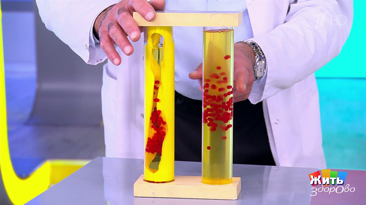 Пальмовое масло опасно для здоровья? Жить здорово! Фрагмент выпуска от 20.10.2025 смотреть онлайн