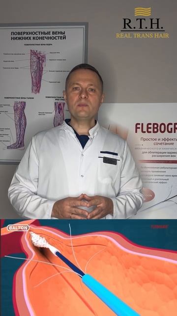 Флебогриф: революция в лечении варикоза без разрезов и наркоза! смотреть онлайн