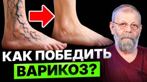 Вы не ударялись, а синяки всё равно появляются? Опасный сигнал, который глупо игнорировать: