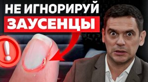 После этого видео ты ПЕРСТАНЕШЬ отрывать заусенцы! (они больше не появятся)
