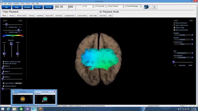 Обзор _до_ и _после_ сессии #accessbars от нейробиолога доктора Джеффри Феннина и Гари Дагласа