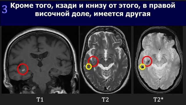 Introduction to MRI of the brain / Введение в МРТ головного мозга смотреть онлайн