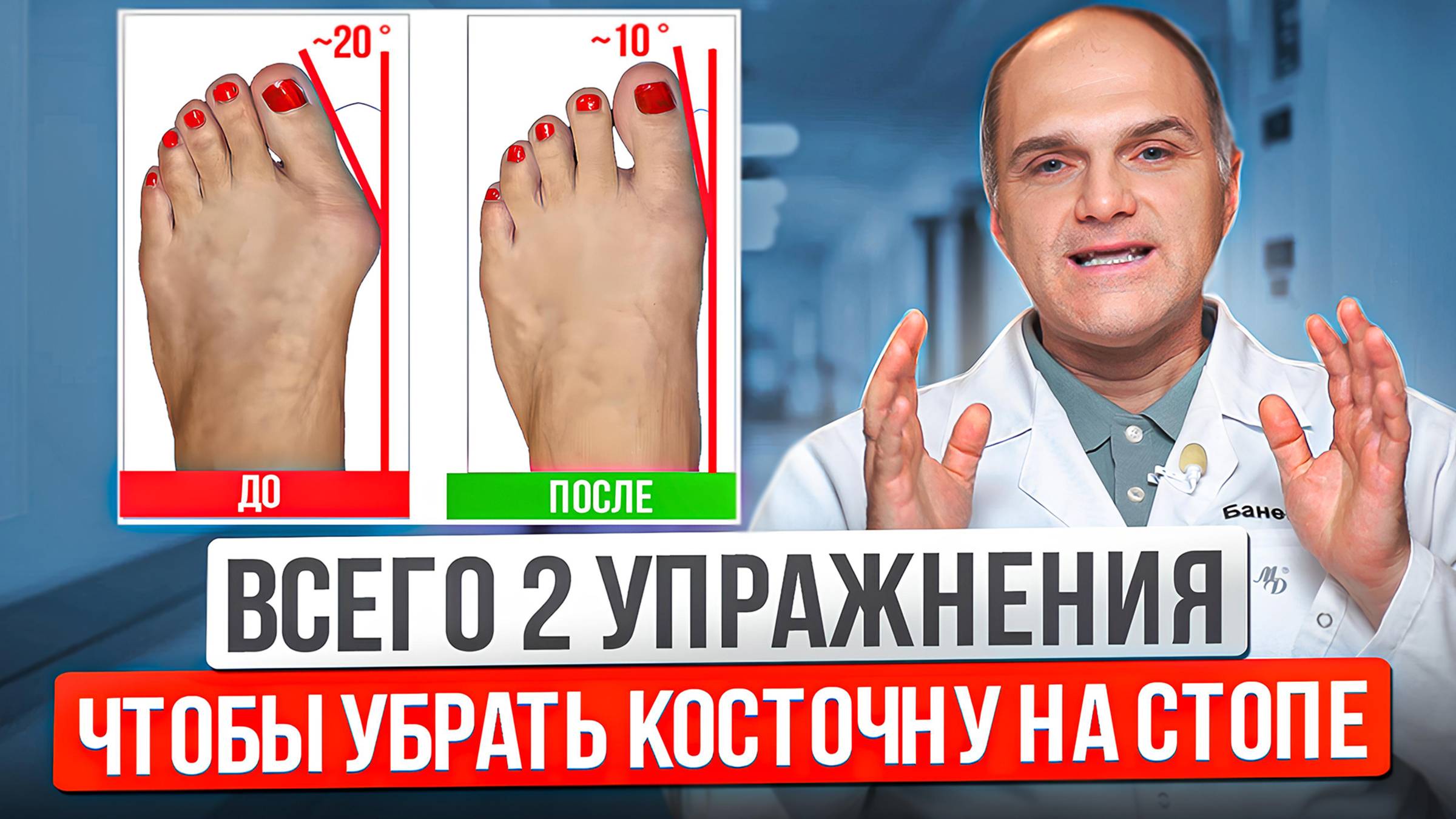 Упражнения для стоп смотреть онлайн