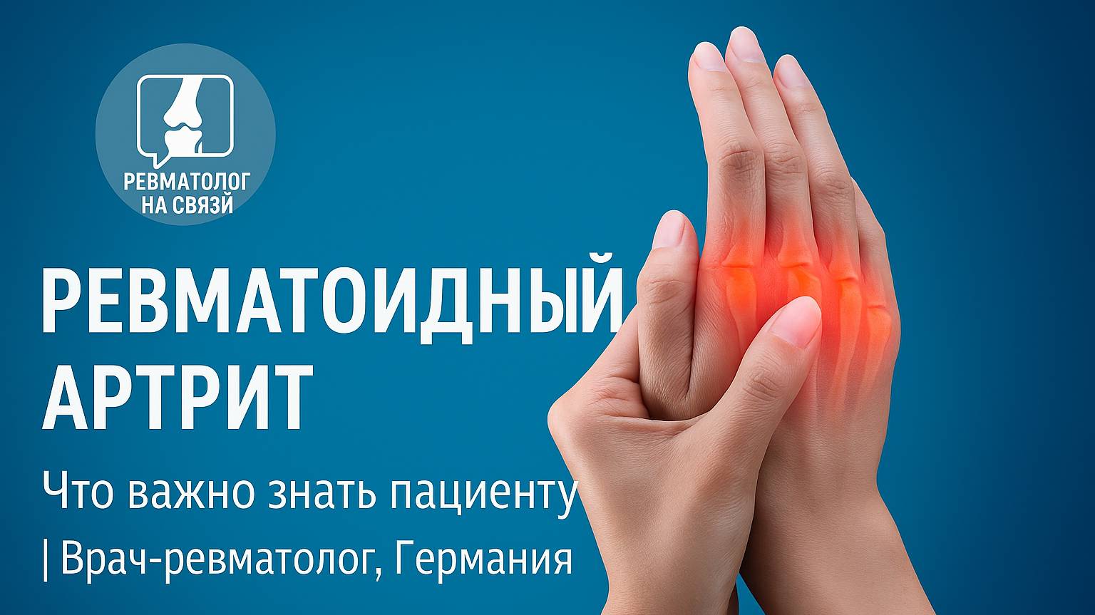 Ревматоидный артрит: диагностика, лечение и советы практикующего врача