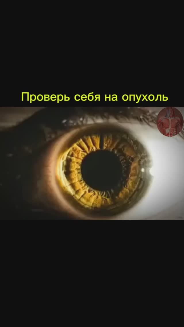 Признак опухоли мозга смотреть онлайн