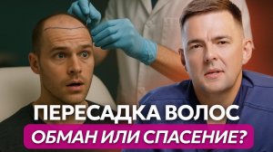 Пересадка волос: кому поможет, а кому нет? Все за и против