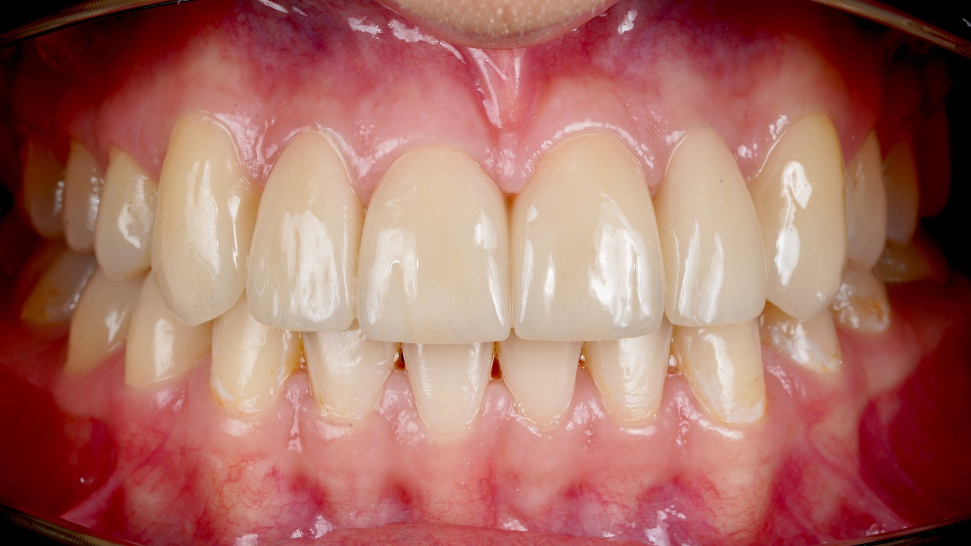 СТАРТ-ГИГИЕНА-РММА-САНАЦИЯ-ОРТОДОНТИЯ-ЦИРКОН-ФИНИШ
