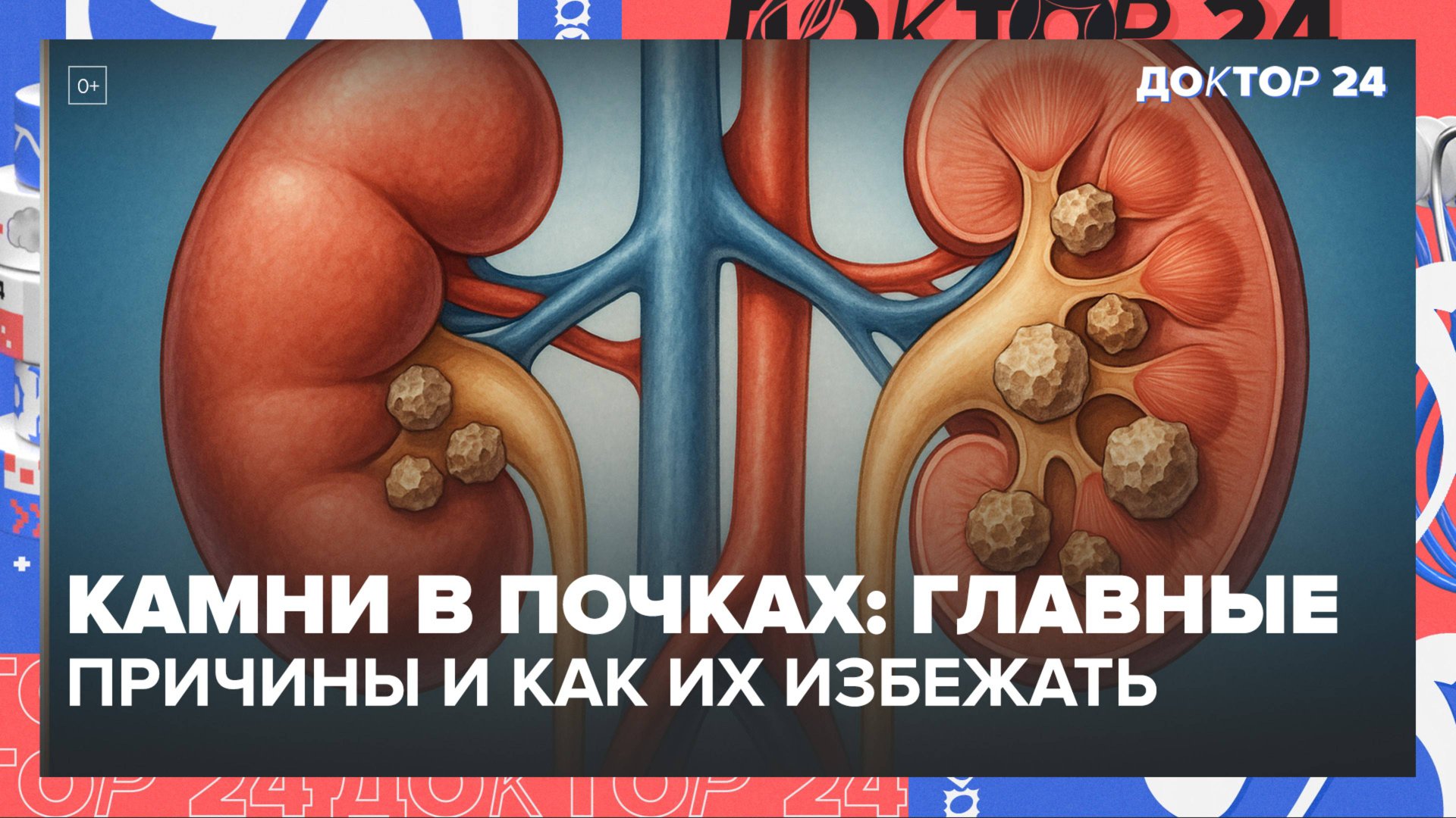 Камни в почках: главные причины и как их избежать | Врач-диетолог объясняет смотреть онлайн