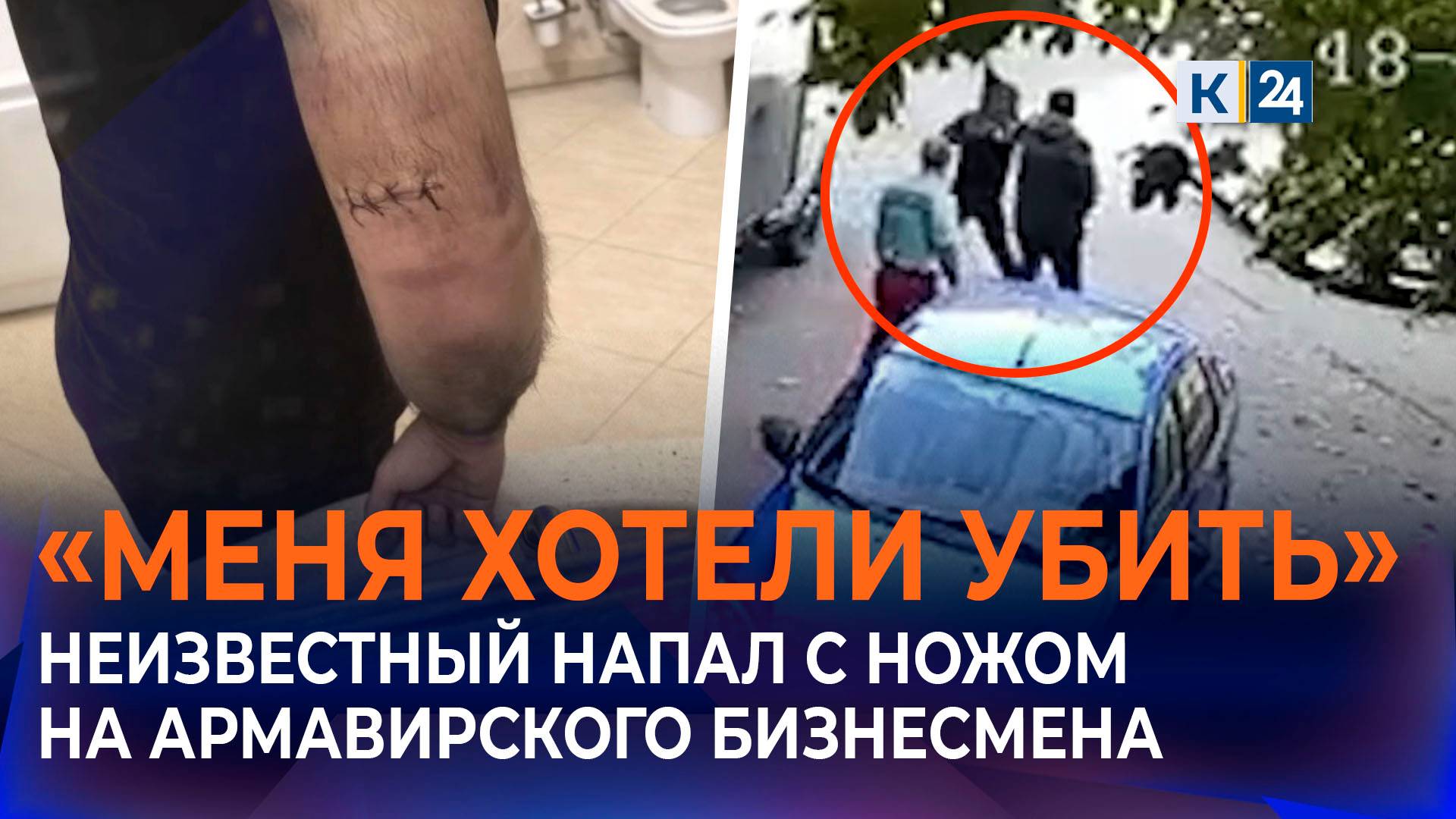 Неизвестный напал с ножом на армавирского предпринимателя смотреть онлайн