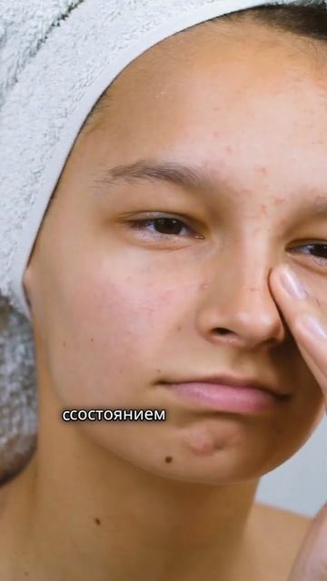 О чем говорят прыщи на теле?