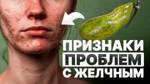 Секрет идеальной кожи и волос / Как понять, что с ЖЕЛЧНЫМ пузырем не все в порядке?