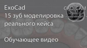 Моделирование 15 зуба