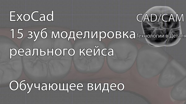Моделирование 15 зуба