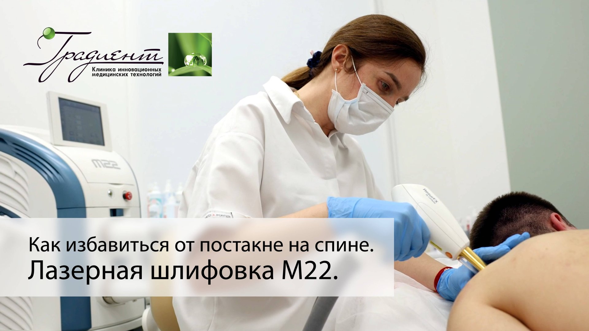 Как избавиться от постакне на спине с помощью лазерной шлифовки на М22 Resur FX смотреть онлайн