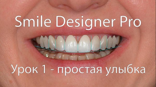 Smile Designer Pro: Урок 1 - простая улыбка