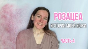 РОЗАЦЕА. ИСТОРИЯ МОЕЙ КОЖИ. ЧАСТЬ 4: НОВЫЙ ПОДХОД К ЛЕЧЕНИЮ