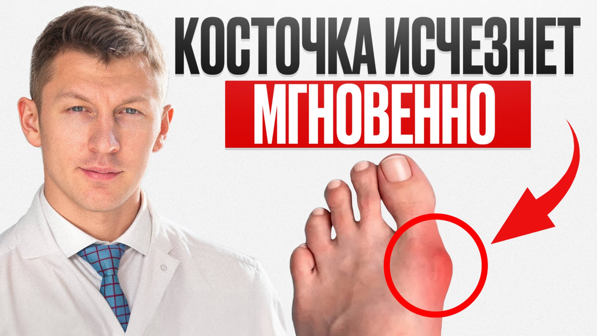 Нужно расслабить 1 мышцу и ВАЛЬГУС ИСЧЕЗНЕТ навсегда! смотреть онлайн