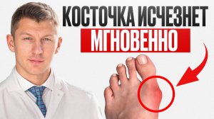 Нужно расслабить 1 мышцу и ВАЛЬГУС ИСЧЕЗНЕТ навсегда!