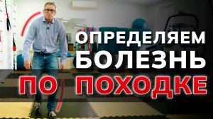 Вот что видит врач: КАК ПО ПОХОДКЕ узнать, что у вас болит
