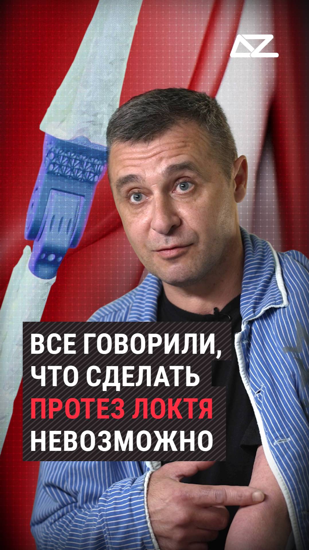 Бойцу все говорили, что сделать протез локтя невозможно смотреть онлайн