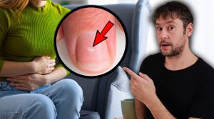 ПЕРВЫЕ Симптомы ЯЗВЕННОГО КОЛИТА, Которые Все ИГНОРИРУЮТ