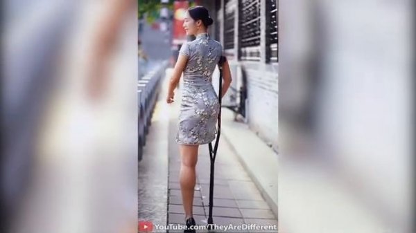 Beautiful Amputee Lady in Dress