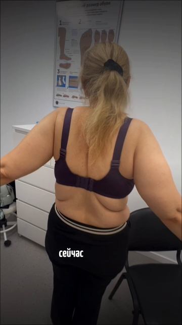 Укол в плечевой сустав. До и После. Смотреть!