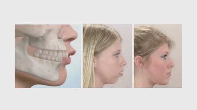 Куда пропадает четкий овал лица 🤯 Разбор проблем и решение + простой ТЕСТ смотреть онлайн