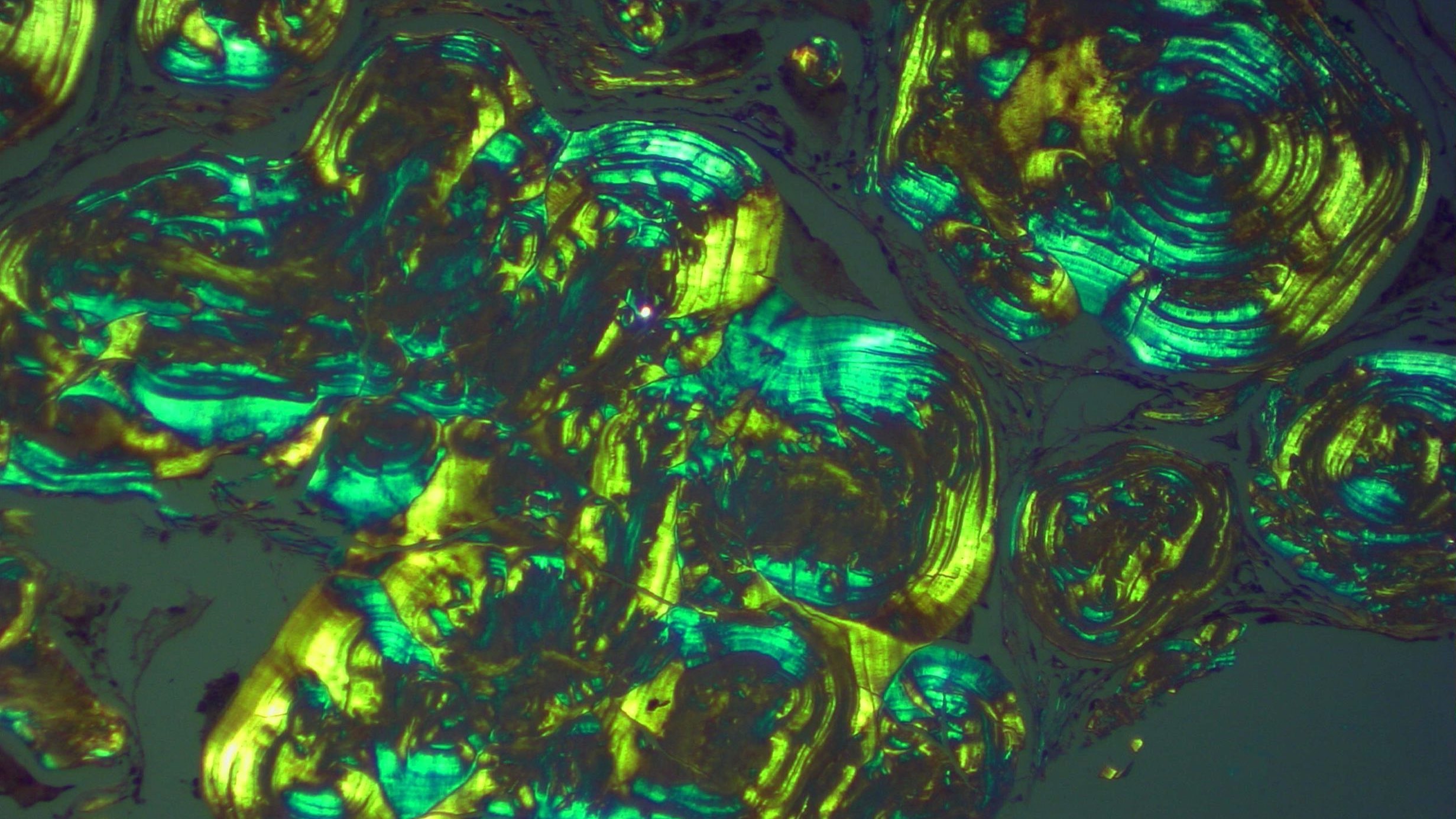 Иммунопатологические процессы смотреть онлайн