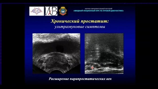 24 Лучевая диагностика заболеваний мочеполовой системы смотреть онлайн