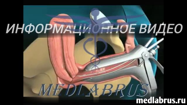 Биопсия эндометрия