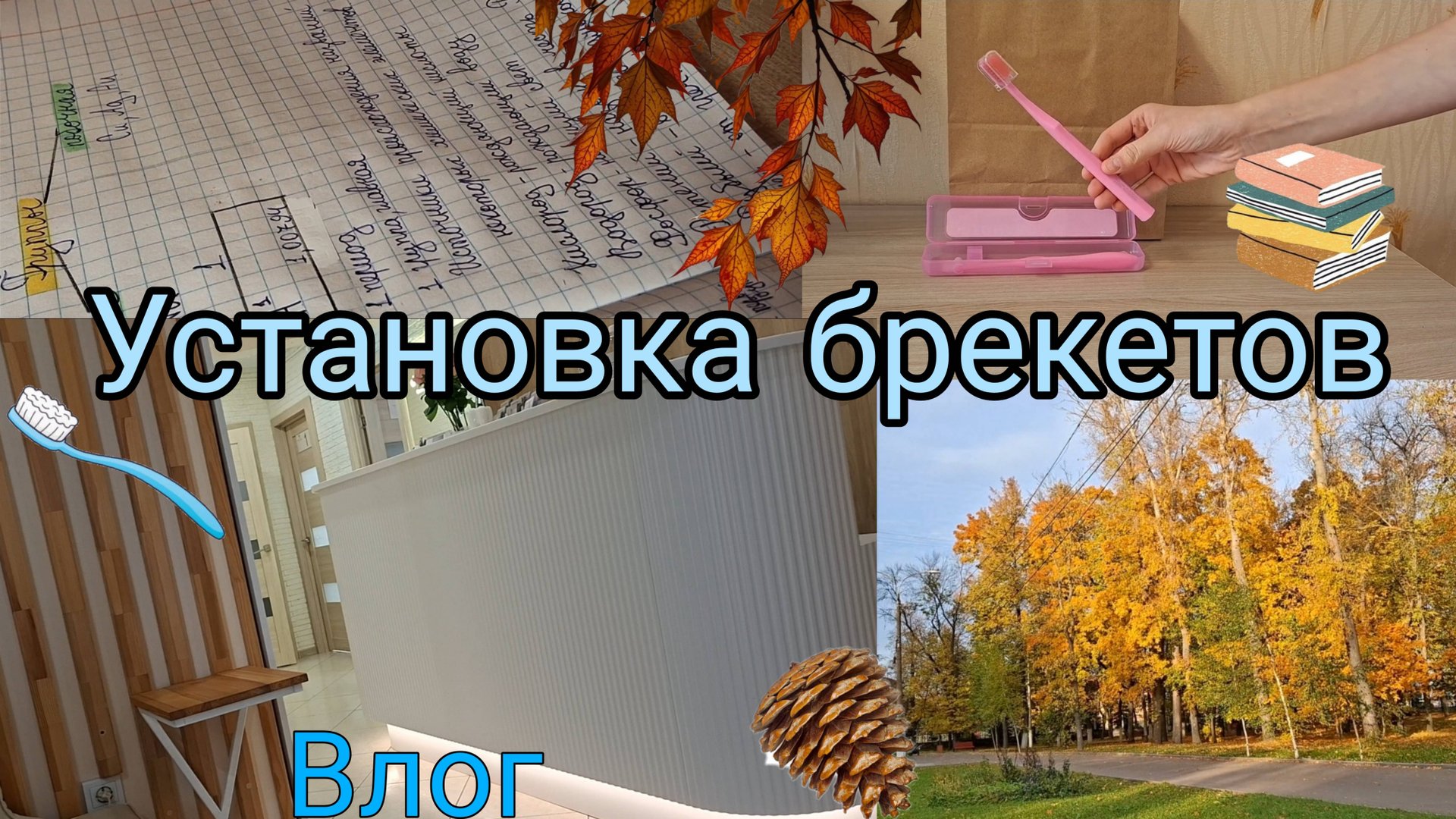 Установка брекетов | Влог