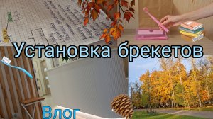 Установка брекетов | Влог