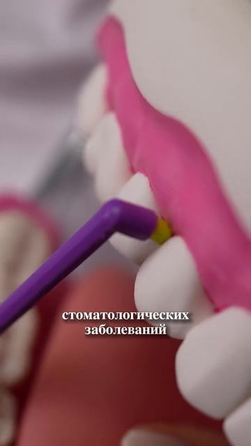 Стоматологический чекап: можно ли обойтись без него смотреть онлайн