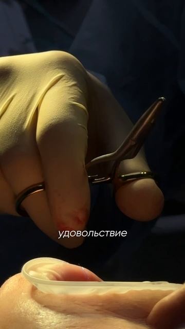 Базальная имплантация за две недели │ отзыв Roott смотреть онлайн