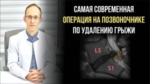 Эндоскопическое удаление грыжи межпозвонкового диска L5-S1 показания, суть операции, риски, реабилит