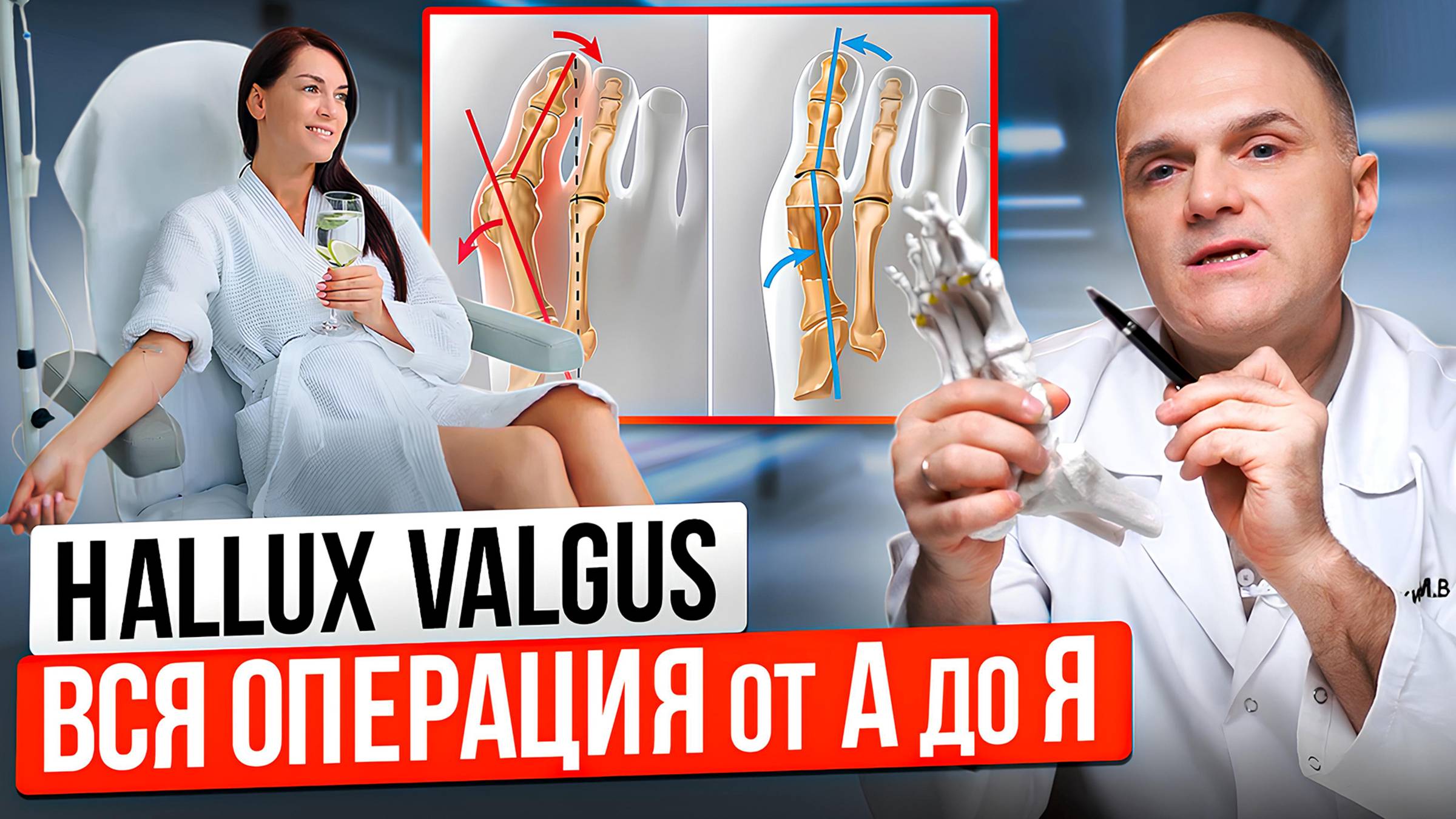 Не делайте операцию Халюс Вальгус пока не посмотрите это видео. Как проходит операция Hallux Valgus. смотреть онлайн