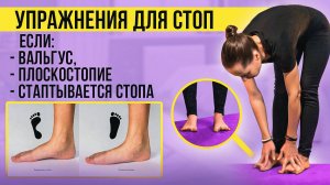 ПЛОСКОСТОПИЕ и ВАЛЬГУС?Упражнения, которые работают в домашних условиях.