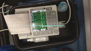 Регистрация экг по Нэбу / Небу